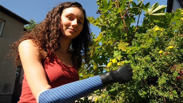 Díky dobročinnosti lidí si Kamila Šabršulová už bionickou ruku nemusí jen půjčovat. Už je její.