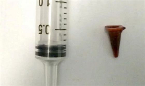 Malý dopravní kuel, který lékai vytáhli z plic 47letého mue