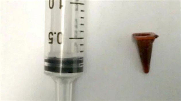 Malý dopravní kuel, který lékai vytáhli z plic 47letého mue