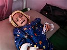 Mnoho jemenských dtí trpí podvýivou. Poslední záchranou jsou pro n speciální...