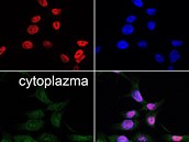 V nádorových buňkách lidského střeva byl protein p53 označen pomocí protilátky....