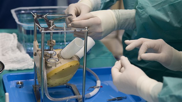Lékaři z pražského Institutu klinické a experimentální medicíny na konci listopadu poprvé implantovali biokompatibilní umělé srdce českému pacientovi.