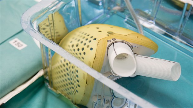 Lékaři z pražského Institutu klinické a experimentální medicíny na konci listopadu poprvé implantovali biokompatibilní umělé srdce českému pacientovi.