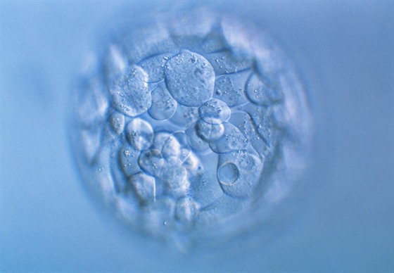 Blastocysta - jedna z embryonálních fází při vývoji savců.