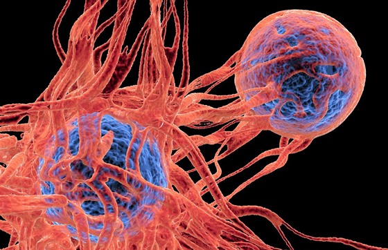 Rakovinotvorná buňka (ilustrační fotografie)