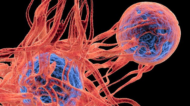 Karlovy Vary bölgesinin kendi onkoloji merkezi olacak