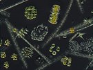 Sinice a asy pod mikroskopem
