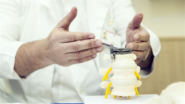 Model znázorňující funkci unikátního implantátu, který vymyslel lékař olomoucké fakultní nemocnice Lumír Hrabálek.