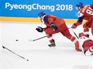 eský hokejista Adam Poláek piel po ruském seknutí o hokejku. (23. února...