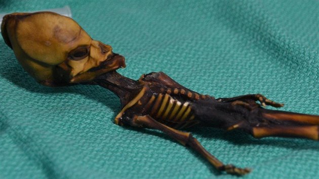 Holiku nalezenou v roce 2003 v chilsk pouti lid dlouh lta povaovali za mimozemana nebo mumii. Vdci dky testm DNA prokzali, e jde o tce postien dt, kter se pravdpodobn narodilo mrtv nebo zemelo pr dn po svm narozen.