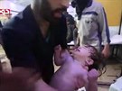 V Sýrii ve mst Dúmá zahynulo nejmén 70 lidí na následky údajn chemického...