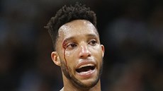 Evan Turner z Portlandu si ze zápasu se San Antoniem odnesl zranní.