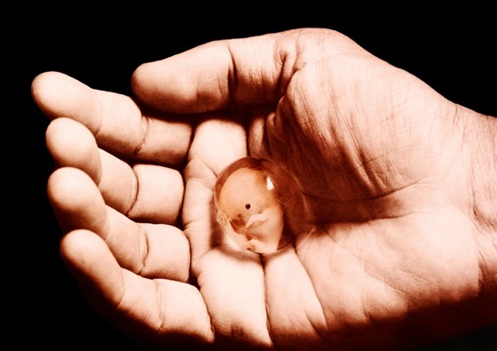 Snímek plodu v 8. týdnu těhotenství