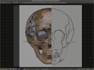 3D snímek lebky doplněný o dopočítanou a domodelovanou čelist. 