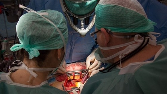Kardiochirurgické operace.