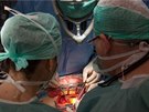 Kardiochirurgick operace.