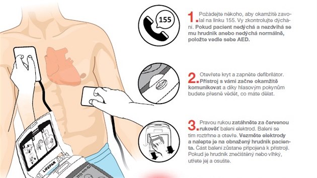 Jak správně použít defibrilátor - infografika