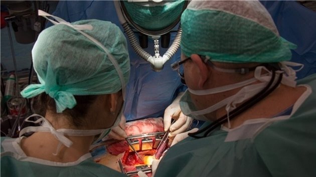 Kardiochirurgick operace.