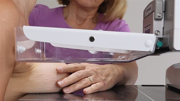 Ženy se silikonovými implantáty odkládají vyšetření na mamografu. Bojí se, že...