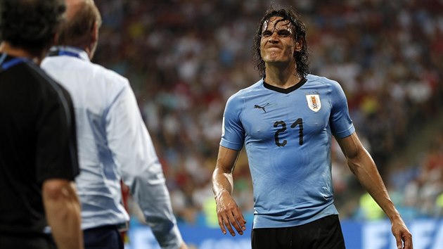 dinson Cavaniz Uruguaye signalizuje, e mu zrann nedovol pokraovat v zpase s Portugalskem.