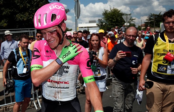 Zkrvavený Lawson Craddock v cíli první etapy Tour de France.