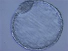 První hybridní embryo vzniklé spojením semene získaného z uhynulého samce...