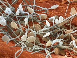 Microcosmos (Brandon Broll)