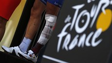 Levá noha Philippeho Gilberta po ošklivém pádu v šestnácté etapě Tour de France.