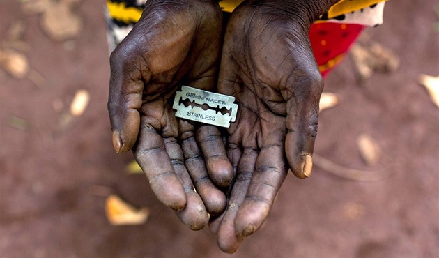 Barbarství nekončí: ženské obřízky přibývají, postižených žije na 230 milionů