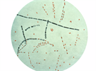 Takto vypadá Bacillus anthracis pod mikroskopem.
