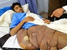 Léka, který Essu operoval, nikdy v ivot tak velký nádor u pákistánského...