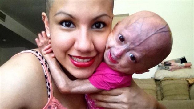 Adalia Rose