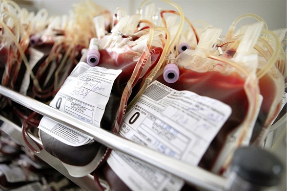 Diag Human se s Českem pře kvůli obchodu s krevní plazmou.
