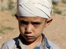 Počet Jemenců na pokraji hladomoru by mohl v příštích měsících narůst až na...