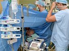 Pacient Fakultn nemocnice u sv. Anny v Brn pi operaci ndoru na plci dchal...