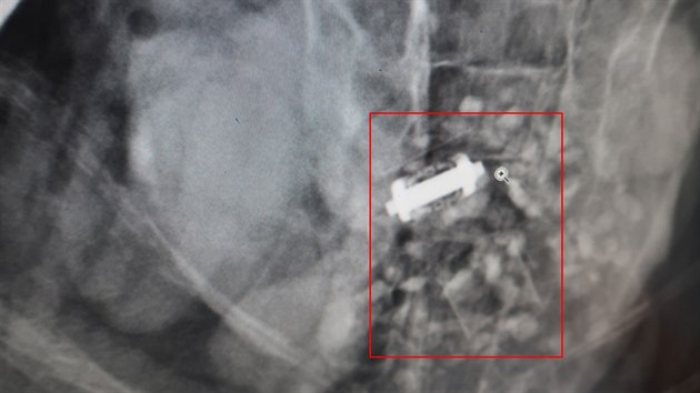 Záhadný předmět, který zvířecí záchranáři odhalili při rentgenování v zažívacím traktu zraněného a těžce létajícího orla mořského v Újezdu u Chanovic. (28. října 2018)
