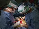 Hemikorporektomie trvala �estn�ct hodin a pod�lelo se na n� dvaadvacet...
