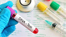 vzorek DNA (ilustraní foto)
