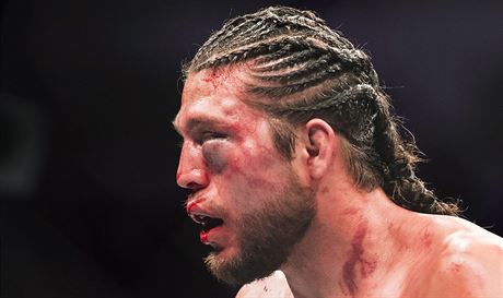 Brian Ortega na zpase v MMA organizace UFC schytal mnoho ran do oblieje