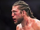 Brian Ortega na zápase v MMA organizace UFC schytal mnoho ran do oblieje