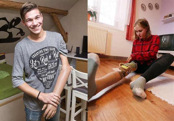 Milo i Natálie se díky vánoní sbírce dokají nové bionické protézy.
