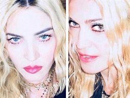 Madonna díky plastickým chirurgm vypadá poád stejn. 