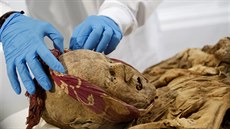 Francouzský patolog Philippe Charlier zkoumá ekvádorskou mumii z 16. století...
