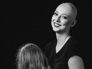 Agáta Ulrichová trpí alopecií universalis, nemocí, při které pacient přijde...