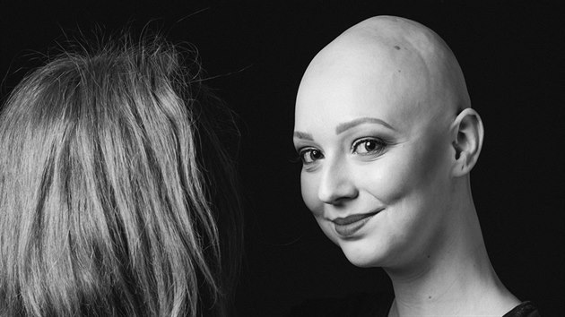 Agta Ulrichov trp alopeci universalis, nemoc, pi kter pacient pijde nejen o vlasy, ale o veker ochlupen. V roce 2018 se stala ambasadorkou projektu Za normln holky.