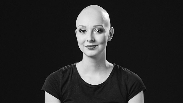 Agta Ulrichov trp alopeci universalis, nemoc, pi kter pacient pijde nejen o vlasy, ale o veker ochlupen. V roce 2018 se stala ambasadorkou projektu Za normln holky.
