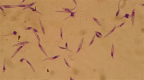 Parazitití prvoci Leishmania, které penáí mouchy, zpsobující onemocnní...