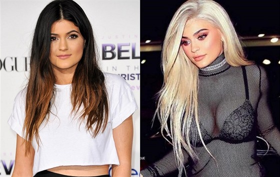 Kylie Jennerová se od roku 2013 dost změnila. Přesto stále tvrdí, že...