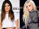 Kylie Jennerová se od roku 2013 dost zmnila. Pesto stále tvrdí, e...