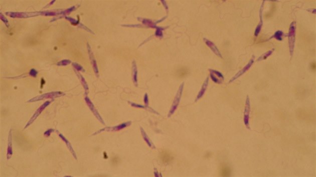 Parazitití prvoci Leishmania, které penáí mouchy, zpsobující onemocnní...